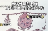 皮肤爆痘留印又留坑的真相